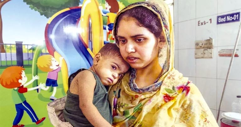 দেশে হামের উপসর্গে ১৯ দিনে ৯৪ শিশুর মৃত্যু, আক্রান্ত ৫৭৯২